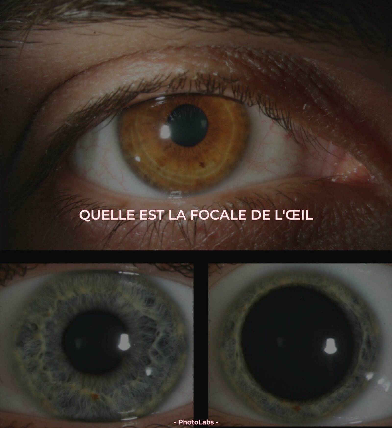Quelle est la focale de l'œil ?