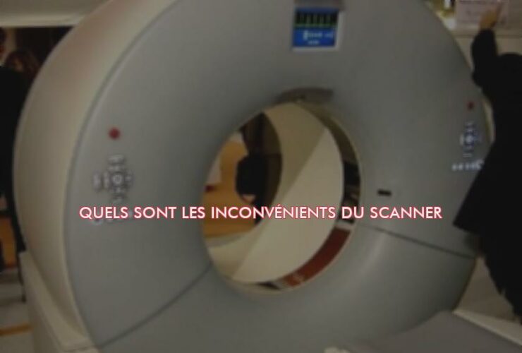Quels sont les inconvénients du scanner ?