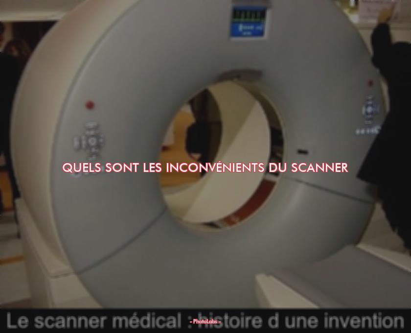 Quels sont les inconvénients du scanner ?
